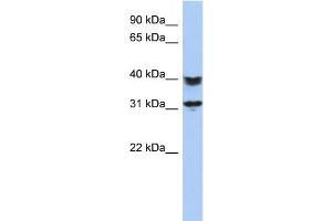WB Suggested Anti-C5orf35 Antibody Titration: 0. (C5orf35 Antikörper  (N-Term))