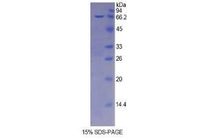 SDS-PAGE (SDS) image for Protease, serine, 8 (PRSS8) (AA 30-339) protein (His tag,GST tag) (ABIN1879098)