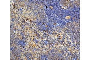 IHC analysis of IL31 using anti-IL31 antibody (ABIN6719334). (IL-31 Antikörper  (AA 24-164))