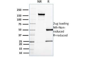 SDS-PAGE Analysis Purified CDC34 Mouse Monoclonal Antibody (CPTC-CDC34-2). (CDC34 Antikörper)