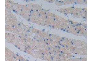DAB staining on IHC-P; Samples: Mouse Heart Tissue (Cadherin 13 Antikörper  (AA 478-690))