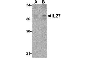 Western blot analysis of IL-27 in EL4 lysate with AP30420PU-N IL-27 antibody at (A) 2 and (B) 4 μg/ml. (IL27 Antikörper  (N-Term))