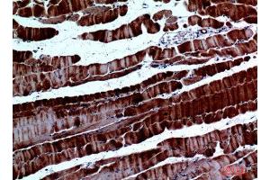 Immunohistochemistry (IHC) image for anti-Secreted Protein, Acidic, Cysteine-Rich (Osteonectin) (SPARC) (Internal Region) antibody (ABIN6281361)