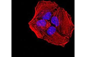 Immunofluorescence (IF) image for anti-Activin Receptor Type I (ACRV1) (AA 21-120) antibody (ABIN5611297)