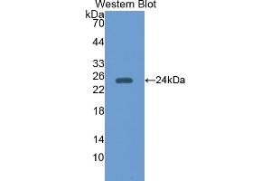 Western blot analysis of the recombinant protein. (Peroxiredoxin 5 Antikörper  (AA 1-213))