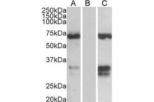 HEK293 lysate (10 µg protein in RIPA buffer) over expressing Human FOXC2 with DYKDDDDK tag probed with ABIN185029 (0. (FOXC2 Antikörper  (C-Term))