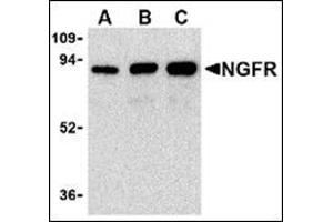 Western blot analysis of (A) 25 ng, (B) 50 ng, and (C) 100 ng of purified recombinant NGFR with this product at 1 μg/ml.