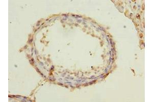 Immunohistochemistry of paraffin-embedded human testis tissue using ABIN7168477 at dilution of 1:100 (RUNDC3A Antikörper  (AA 1-405))