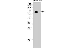Western Blotting (WB) image for anti-Estrogen Receptor 1 (ESR1) (Ser363) antibody (ABIN3184553) (Estrogen Receptor alpha Antikörper  (Ser363))