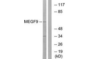 Western blot analysis of extracts from COLO cells, using MEGF9 Antibody. (MEGF9 Antikörper  (AA 383-432))