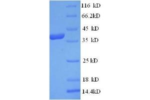 SDS-PAGE (SDS) image for Carboxypeptidase A3 (Mast Cell) (CPA3) (AA 110-417) protein (His tag) (ABIN5713376)