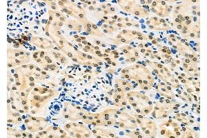 ABIN6262571 and ABIN6277224 at 1/100 staining Rat kidney tissue by IHC-P. (Interleukin enhancer-binding factor 3 (ILF3) (Internal Region) Antikörper)