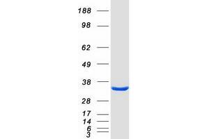 Validation with Western Blot (ECHDC3 Protein (Myc-DYKDDDDK Tag))