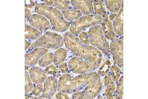 Immunohistochemistry of paraffin-embedded mouse kidney using FKBP6 antibody at dilution of 1:100 (x400 lens). (FKBP6 Antikörper)