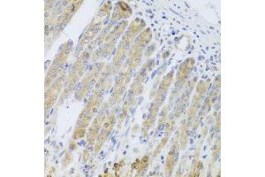 Immunohistochemistry of paraffin-embedded mouse stomach using RARS2 antibody (ABIN5974692) at dilution of 1/100 (40x lens). (RARS2 Antikörper)