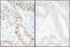 Immunohistochemistry (IHC) image for anti-Minichromosome Maintenance Complex Component 2 (MCM2) (pSer40), (pSer41) antibody (ABIN7449413) (MCM2 Antikörper  (pSer40, pSer41))