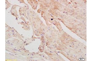 Formalin-fixed and paraffin embedded mouse heart labeled with Rabbit Anti PAPK/ALS2CR2 Polyclonal Antibody, Unconjugated (ABIN751273) at 1:200 followed by conjugation to the secondary antibody and DAB staining (STRADB Antikörper  (AA 251-350))