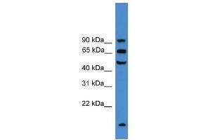 WB Suggested Anti-UMOD Antibody Titration:  0. (Uromodulin Antikörper  (C-Term))