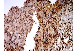 Immunohistochemistry (IHC) image for anti-Transcription Termination Factor, RNA Polymerase I (TTF1) (AA 1-150) antibody (ABIN5871603) (TTF1 Antikörper  (AA 1-150))