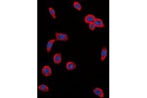 Immunofluorescence (IF) image for anti-VEGF Receptor 2 (VEGFR2) (C-Term), (pTyr1214) antibody (ABIN7303694)