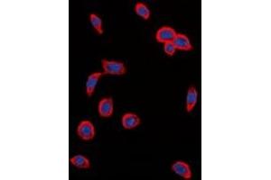 Immunofluorescent analysis of VEGFR2 (pY1214) staining in MCF cells. (VEGFR2/CD309 Antikörper  (C-Term, pTyr1214))