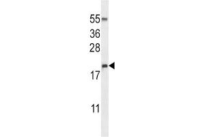 Western Blotting (WB) image for anti-Eosinophil Cationic Protein (ECP) antibody (ABIN2997398) (RNASE3 Antikörper)