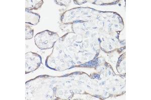 Immunohistochemistry of paraffin-embedded human placenta using CLUH antibody  at dilution of 1:100 (40x lens). (CLUH Antikörper  (AA 1120-1309))