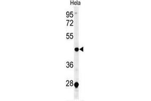 Western blot analysis of CHN2 (arrow) in Hela cell line lysates (35ug/lane) using ARHGAP3/CHN2  (CHN2 Antikörper  (Middle Region))