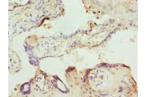 Immunohistochemistry of paraffin-embedded human placenta tissue using ABIN7156320 at dilution of 1:100 (ITPK1 Antikörper  (AA 185-414))