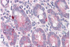 Human Small Intestine (formalin-fixed, paraffin-embedded) stained with SLC9A1 antibody ABIN343902 at 5 ug/ml followed by biotinylated goat anti-rabbit IgG secondary antibody ABIN481713, alkaline phosphatase-streptavidin and chromogen. (SLC9A1 Antikörper  (C-Term))