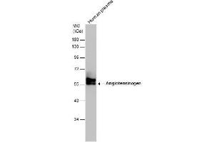 WB Image Human tissue extract (30 μg) was separated by 10% SDS-PAGE, and the membrane was blotted with Angiotensinogen antibody [N1C3] , diluted at 1:500. (AGT Antikörper)