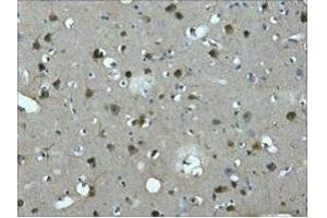 IHC staining of Human brain tissue paraffin-embedded, diluted at 1:200. (MAP2 Antikörper)