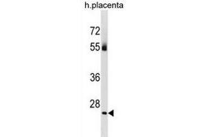 TBC1D26 Antibody (C-term) (ABIN1881871 and ABIN2838991) western blot analysis in human placenta tissue lysates (35 μg/lane). (TBC1D26 Antikörper  (C-Term))