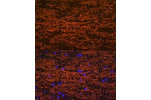 Immunofluorescence analysis of mouse brain using Myelin oligodendrocyte glycoprotein Rabbit mAb (ABIN7268722) at dilution of 1:100 (40x lens). (MOG Antikörper)