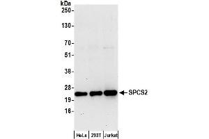 anti-Signal Peptidase Complex Subunit 2 Homolog (SPCS2) (AA 25-75) antibody