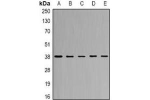 Western blot analysis of CapG expression in SW620 (A), THP1 (B), mouse lung (C), mouse spleen (D), rat heart (E) whole cell lysates. (CAPG Antikörper)