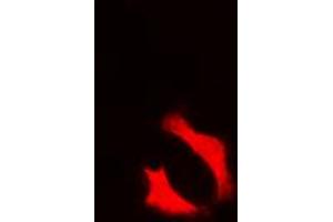 Immunofluorescence (IF) image for anti-Nuclear Factor of Activated T-Cells, Cytoplasmic, Calcineurin-Dependent 4 (NFATC4) (C-Term), (pSer676) antibody (ABIN7301056)