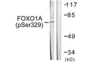 Western blot analysis of extracts from HeLa cells treated with Serum 20% 15', using FOXO1A (Phospho-Ser329) Antibody. (FOXO1 Antikörper  (pSer329))