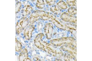 Immunohistochemistry of paraffin-embedded rat kidney using Glycerol kinase (GK) Rabbit mAb (ABIN7267457) at dilution of 1:100 (40x lens). (Glycerol Kinase Antikörper)