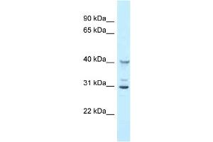 WB Suggested Anti-Oas1g Antibody Titration: 1. (OAS1G Antikörper  (N-Term))