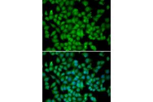 Immunofluorescence analysis of HeLa cells using CDKN2C antibody. (CDKN2C Antikörper)