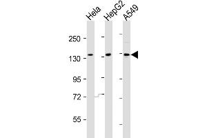 Western Blot at 1:2000 dilution Lane 1: Hela whole cell lysates Lane 2: HepG2 whole cell lysates Lane 3: A549 whole cell lysates Lysates/proteins at 20 ug per lane.