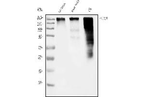 Western blot analysis of SCN2A using anti-SCN2A antibody (ABIN7603160).