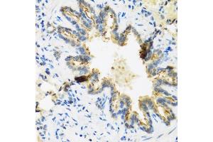 Immunohistochemistry of paraffin-embedded rat lung using DEFB4A antibody (ABIN3015538, ABIN3015539, ABIN3015540 and ABIN6218726) at dilution of 1:100 (40x lens). (DEFB4A Antikörper  (AA 1-64))