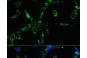 Immunofluorescence analysis of NIH-3T3 cells using BUB1B Polyclonal Antibody at dilution of 1:100. (BUB1B Antikörper)