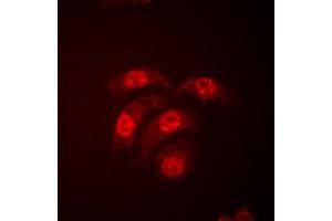 Immunofluorescent analysis of p38 staining in HeLa cells. (MAPK14 Antikörper  (Center))