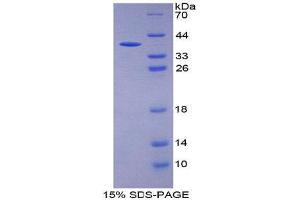 SDS-PAGE (SDS) image for Keratin 13 (KRT13) (AA 104-403) protein (His tag) (ABIN2125538)