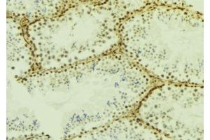 ABIN6277185 at 1/100 staining Mouse testis tissue by IHC-P. (IFIH1 Antikörper  (C-Term))