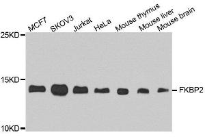 Western blot analysis of extract of various cells, using FKBP2 antibody. (FKBP2 Antikörper)