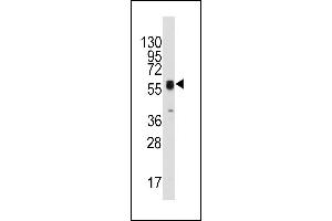 Western blot analysis of anti-ECGF1(Center) Pab (ABIN391460 and ABIN2841435) in HepG2 cell line lysates (35 μg/lane). (Thymidine Phosphorylase Antikörper  (AA 318-345))